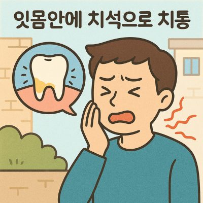 잇몸 안에 치석이 치통(신경통)을 유발할 수 있을까? 2 잇몸 안에 치석 썸네일