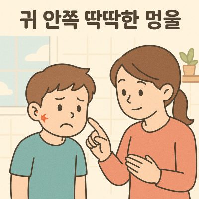 귀 안쪽 딱딱한 멍울, 피지낭종일까? 연골염일까? 1 귀 안쪽 딱딱한 멍울 썸네일