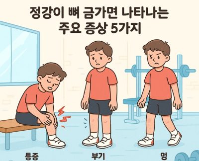 정강이 뼈 금가면 나타나는 주요 증상 5가지 1 정강이 뼈 금 갔을 때 나타나는 통증과 붓기 증상을 표현한 의료 이미지