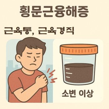 횡문근융해증 증상으로 근육 통증과 소변 이상이 나타나는 건강 경고 이미지
