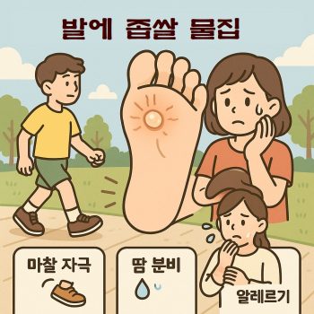 발에 좁쌀 물집이 생긴 원인과 치료법을 설명하는 건강 정보 썸네일