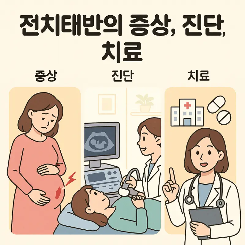 전치태반의 증상과 진단, 치료 방법을 설명하는 임신 합병증 의학정보 썸네일