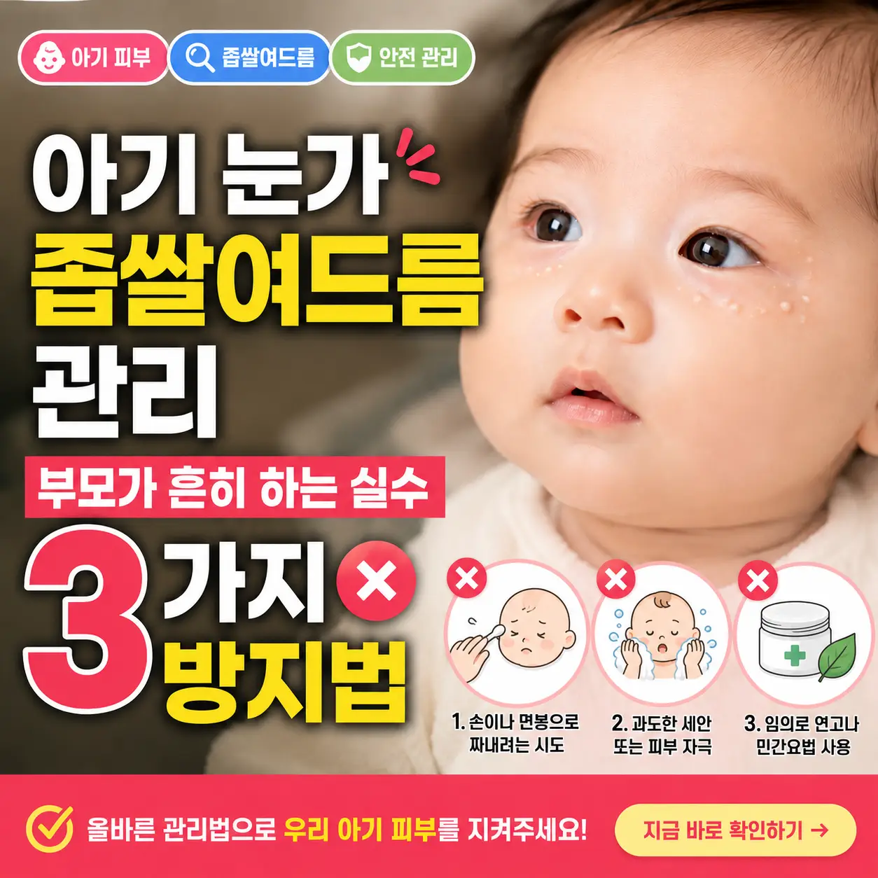 아기 눈가 좁쌀여드름 관리 실수와 방지법을 안내하는 부모용 썸네일 이미지.