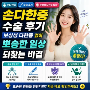 손다한증 수술 후 뽀송한 손으로 일상을 즐기는 여성의 후기 썸네일 이미지