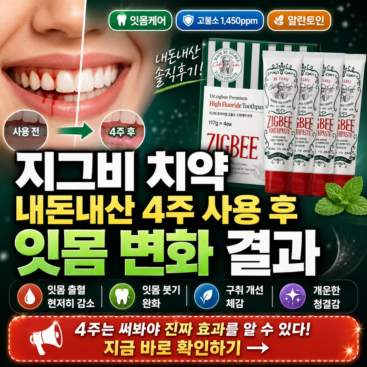 지그비 치약 4주 사용 후 잇몸 출혈과 구취 변화를 강조한 후기 썸네일